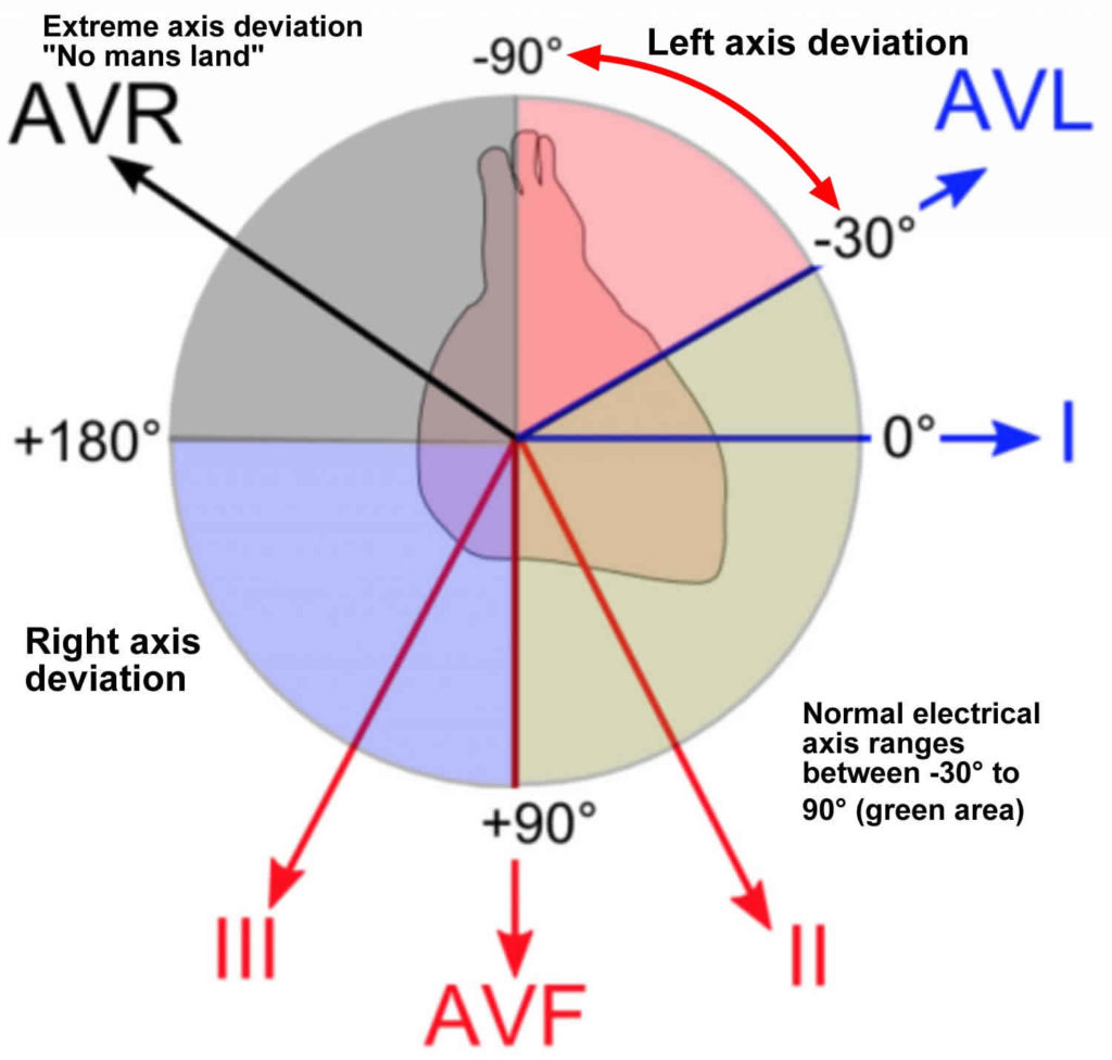 Ecg Diagram And Mean Electrical Axis