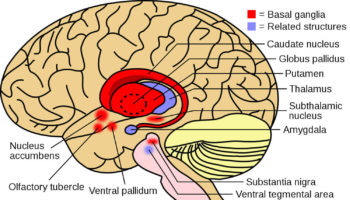 Fahr syndrome