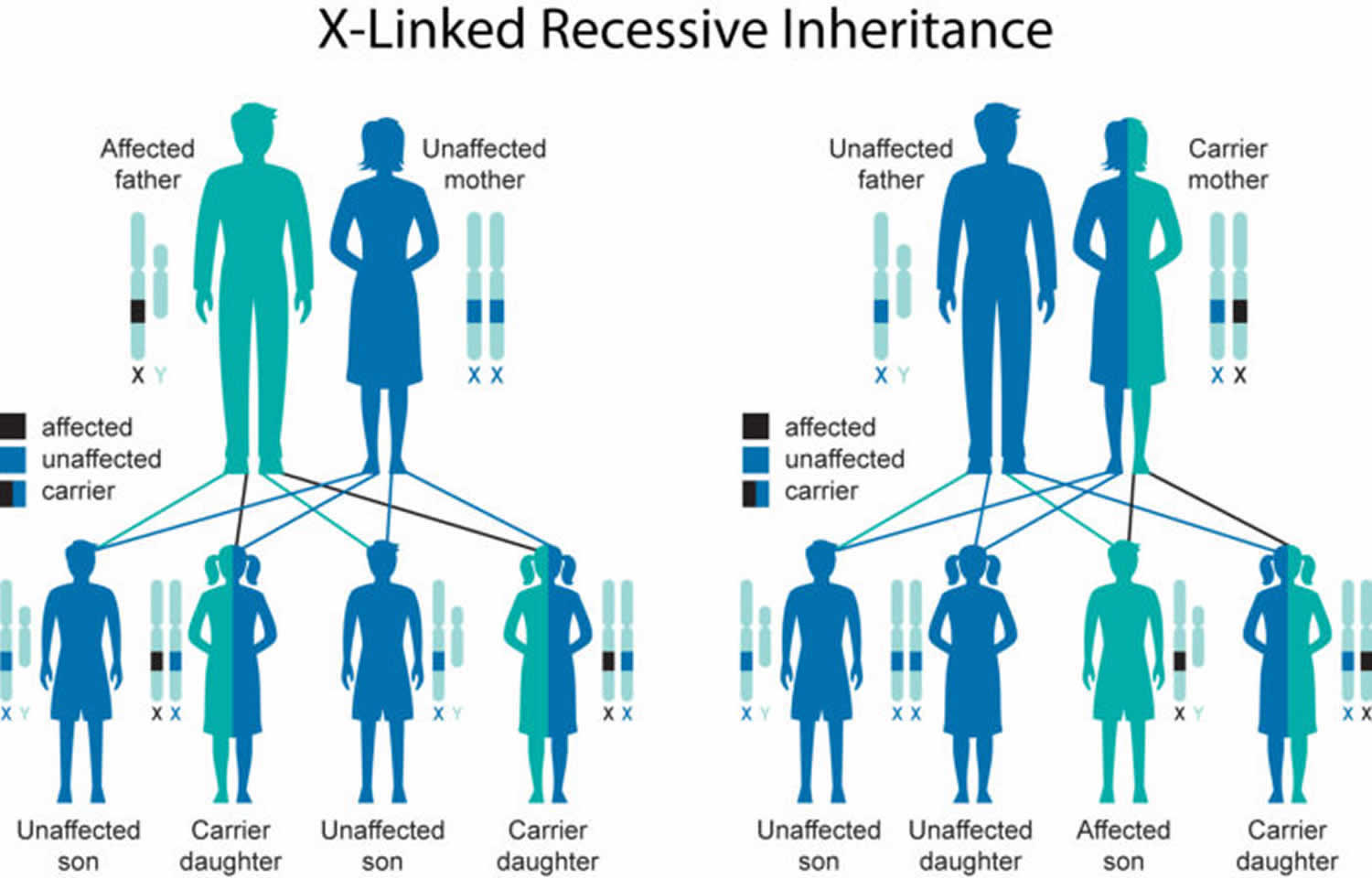 Lowe syndrome X-linked inheritance pattern