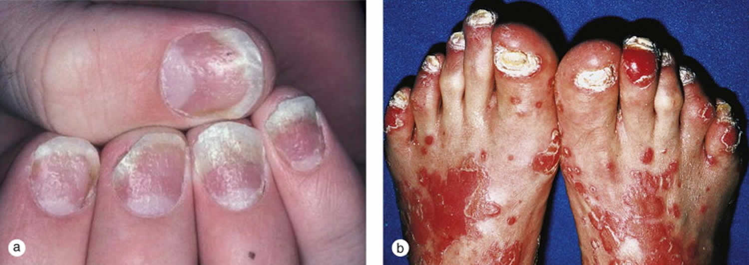 Figure 2 from Trachyonychia and Twenty-Nail Dystrophy: A Comprehensive  Review and Discussion of Diagnostic Accuracy | Semantic Scholar