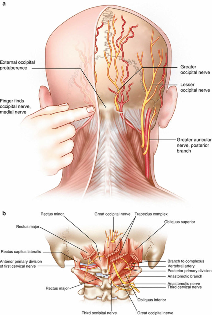 Can Greater Occipital Nerve Causes Migraine