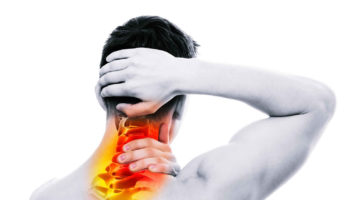 Occipital neuralgia