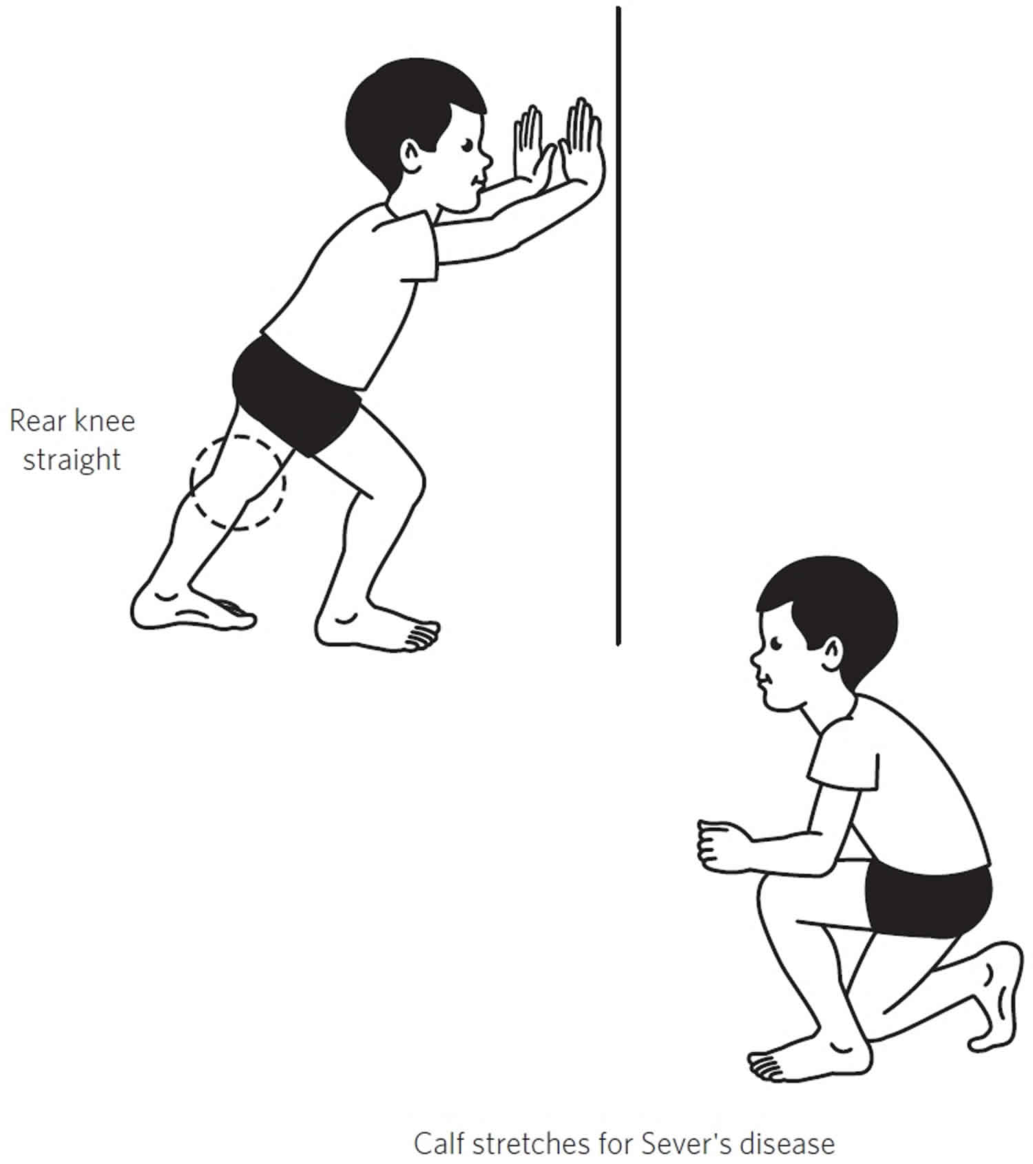 sever's disease treatment exercises