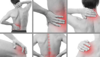 causalgia