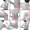 central pain syndrome