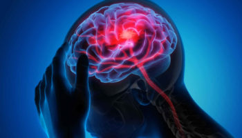 hemispatial neglect