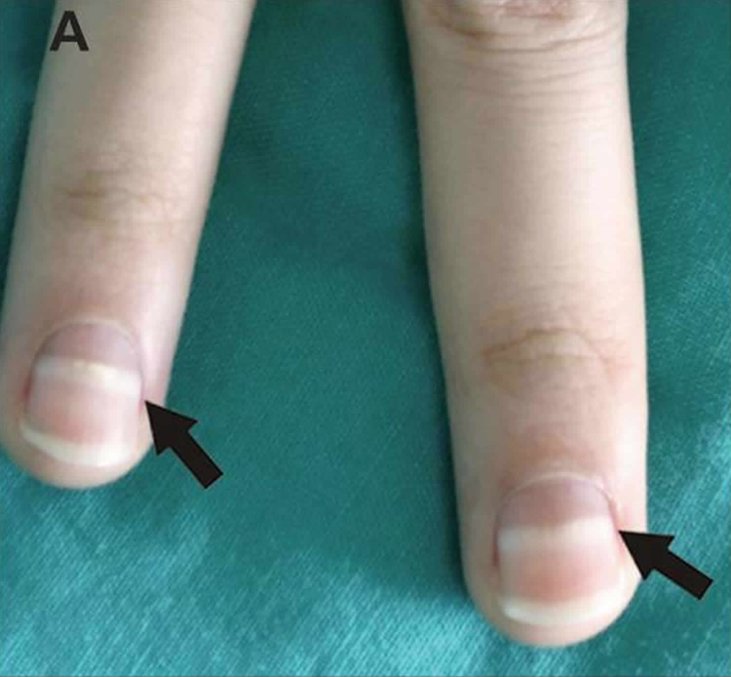 Australian experts reveal common nail problems and what these say about  your health | Daily Mail Online