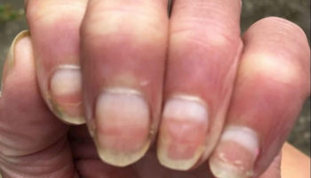 terry’s nails