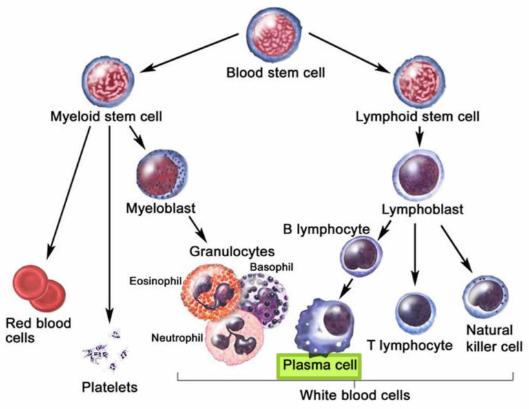 Plasmacytoma causes, symptoms, diagnosis, treatment & life expectancy