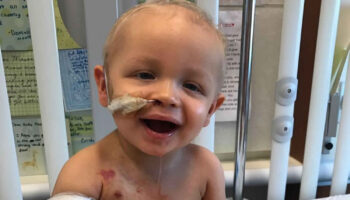 Kostmann syndrome