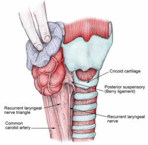 Cricopharyngeal myotomy indications, procedure, complications, recovery ...