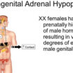 adrenal hypoplasia