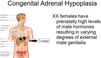 adrenal hypoplasia