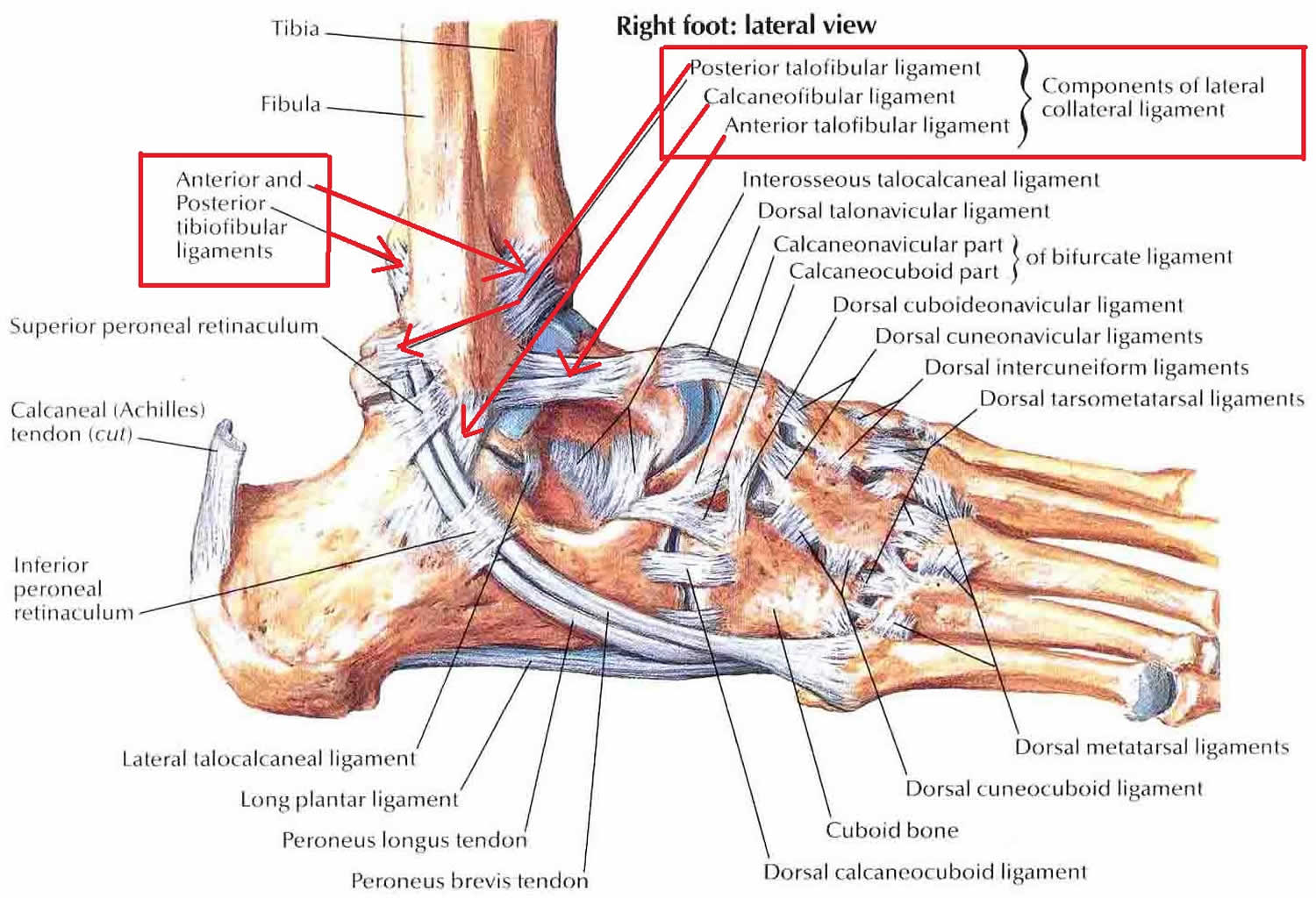 sprain-vs-strain-anatomical-comparison-as-medical-foot-injury-outline