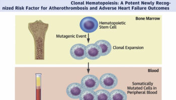 clonal hematopoiesis