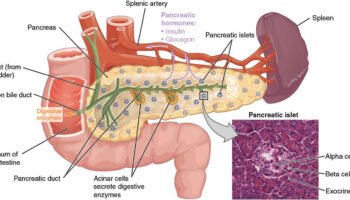 congenital hyperinsulinism