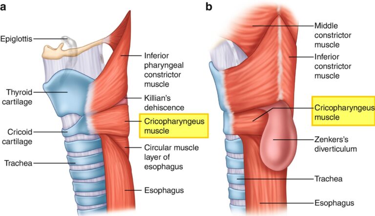 Cricopharyngeal Myotomy Indications, Procedure, Complications, Recovery 