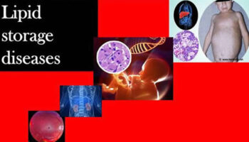 lipid storage diseases