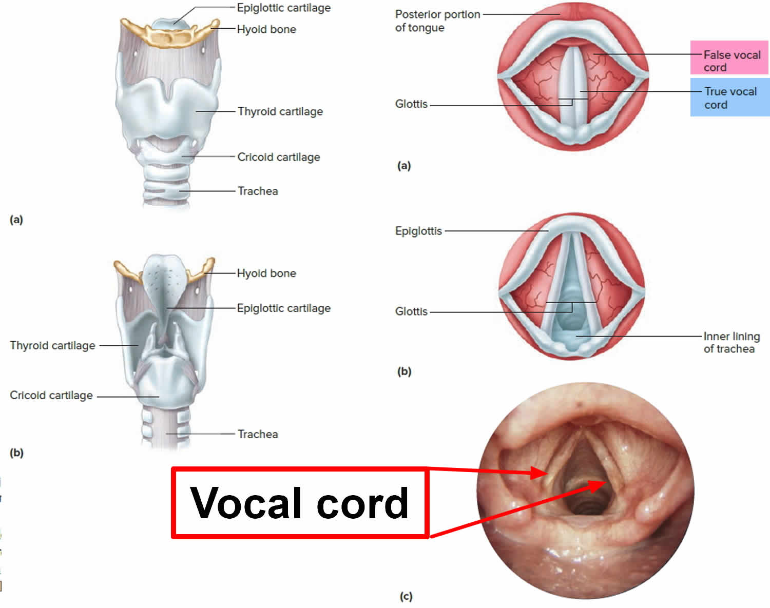 Vocal Cord 