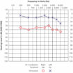 Pure tone audiometry, pure tone audiometry test