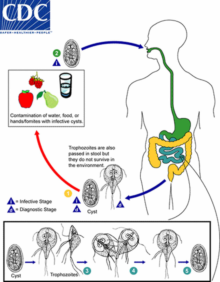 Giardia Duodenalis Causes Prevention Symptoms Diagnosis And Treatment 7392