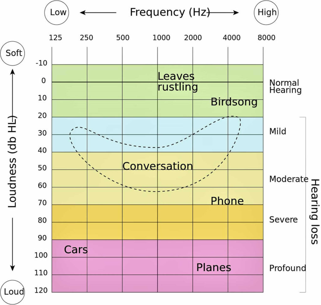 Pure Tone Audiometry Pure Tone Audiometry Test Free Download Nude 