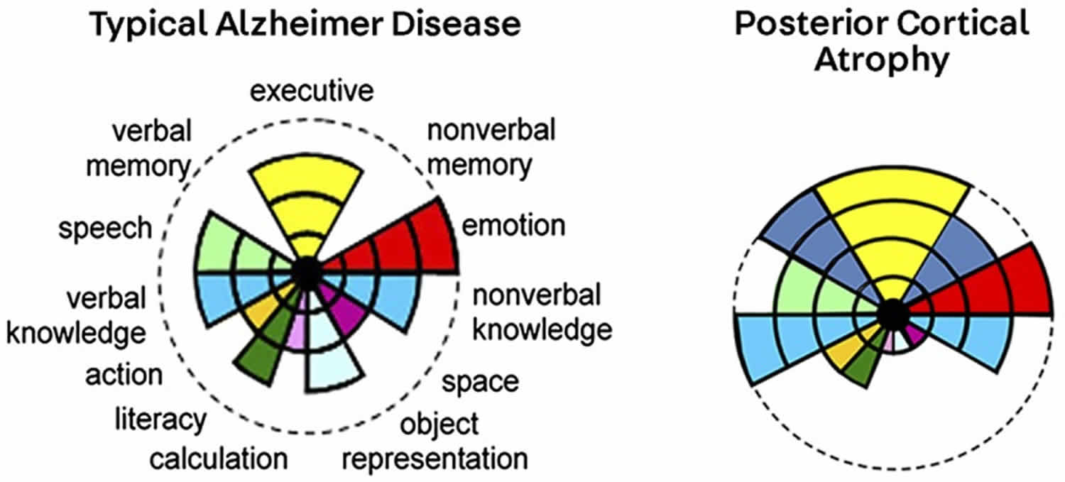 Posterior cortical atrophy causes, symptoms, diagnosis, treatment ...