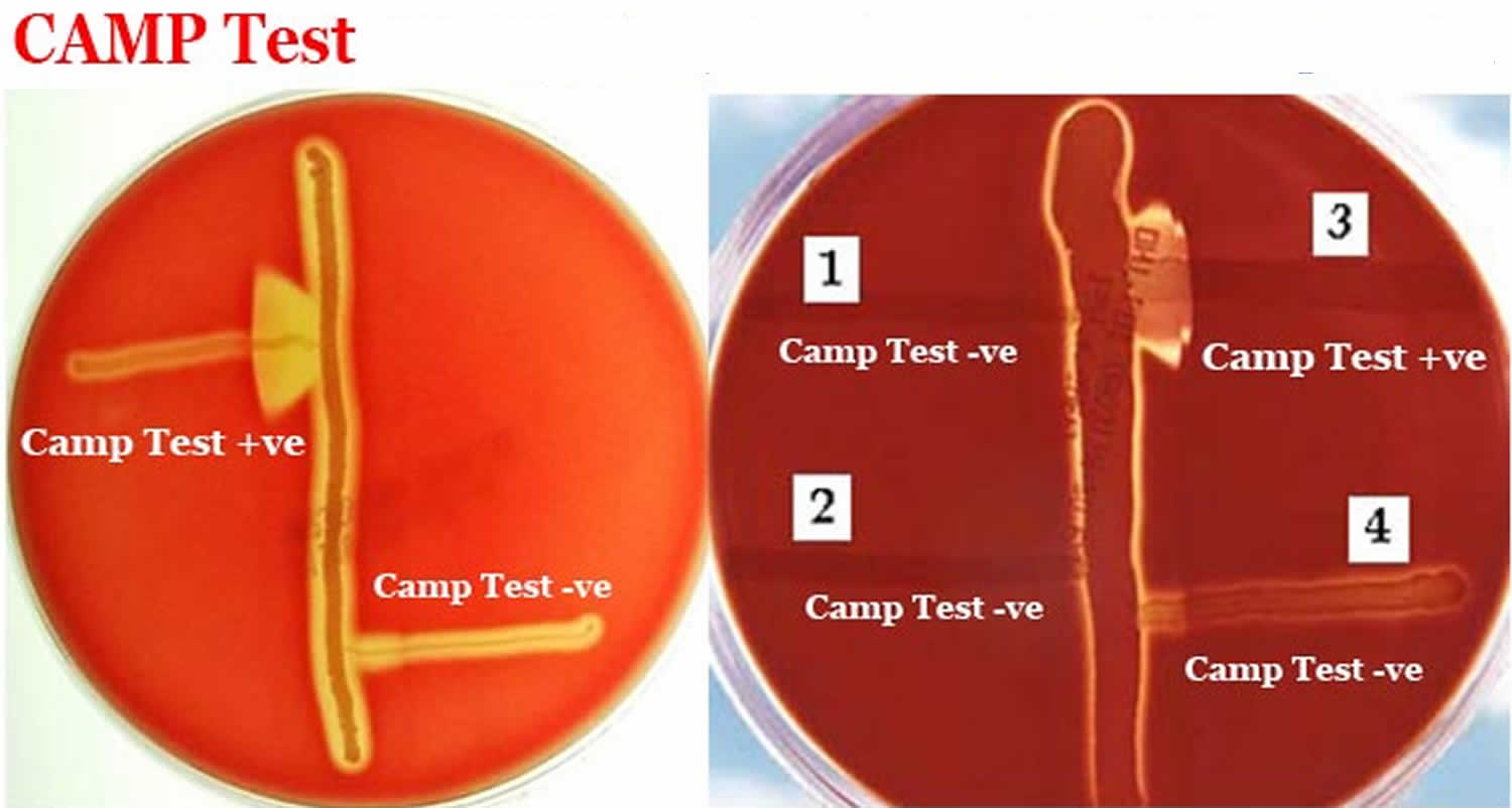 Test sobrecrecimiento bacteriano positivo