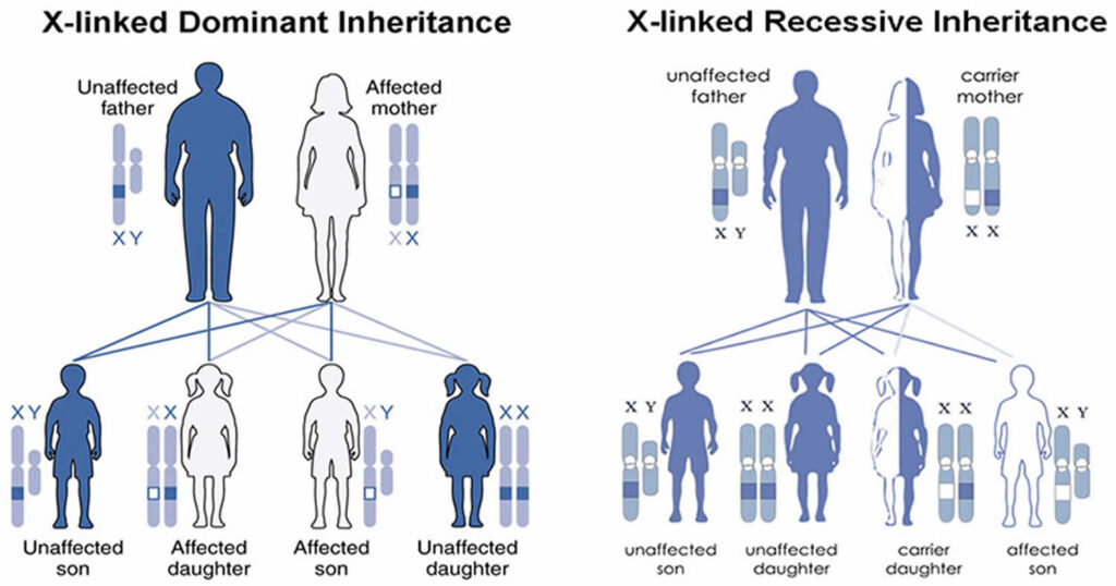 MECP2 duplication syndrome causes, symptoms, diagnosis, treatment ...