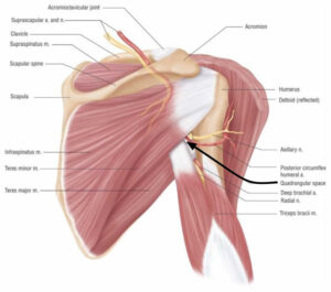 Quadrilateral space syndrome, causes, symptoms, diagnosis, treatment ...