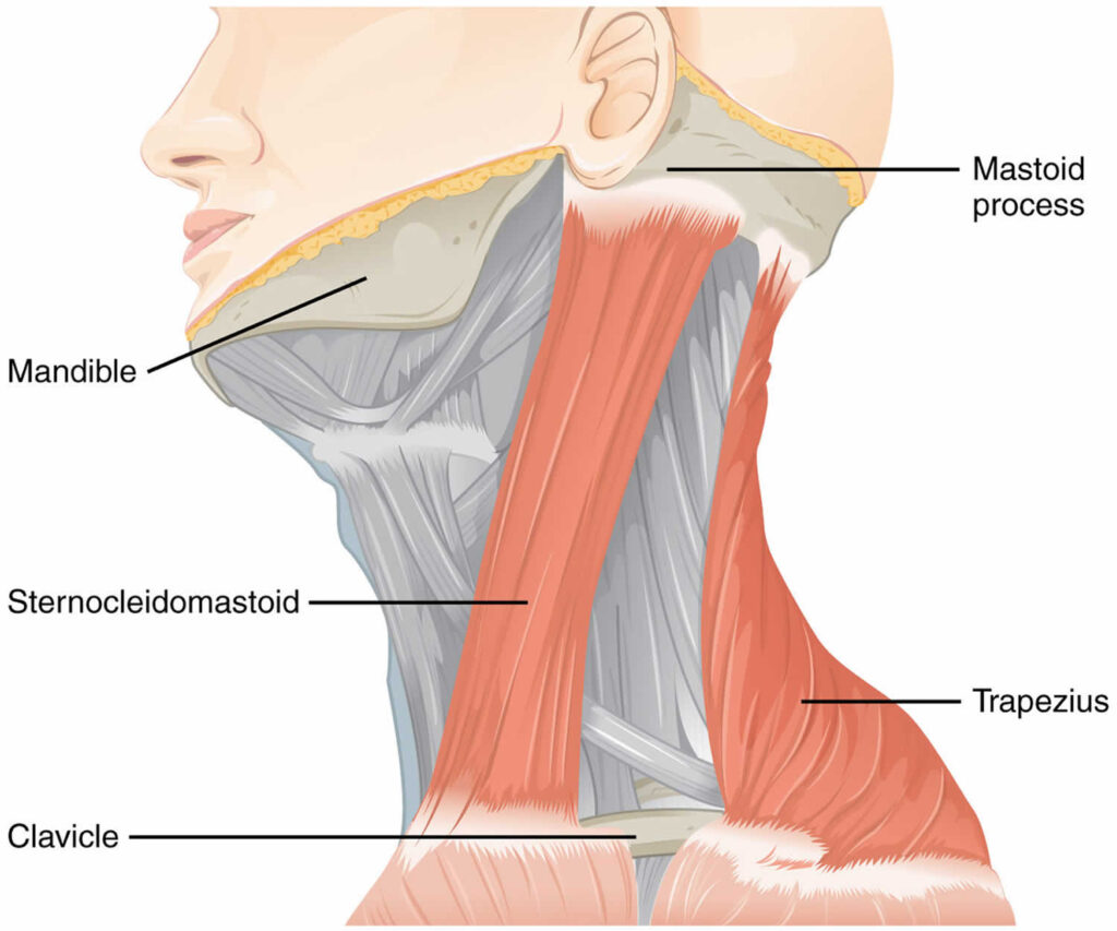 Fibromatosis colli, causes, symptoms, diagnosis, treatment & prognosis