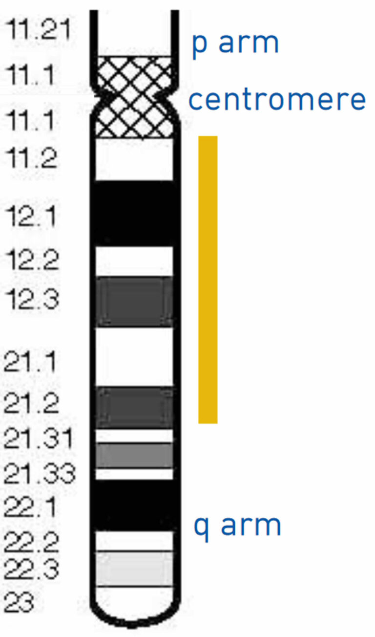 4q-deletion-syndrome-psychiatric-symptoms-in-a-rare-chromosomal