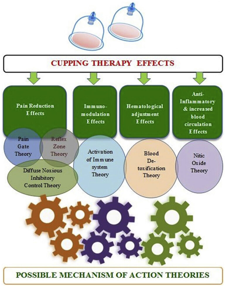 Cupping Therapy, Hijama Therapy, Uses, Side Effects & Contraindications