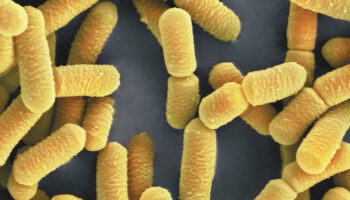 Best probiotics for women