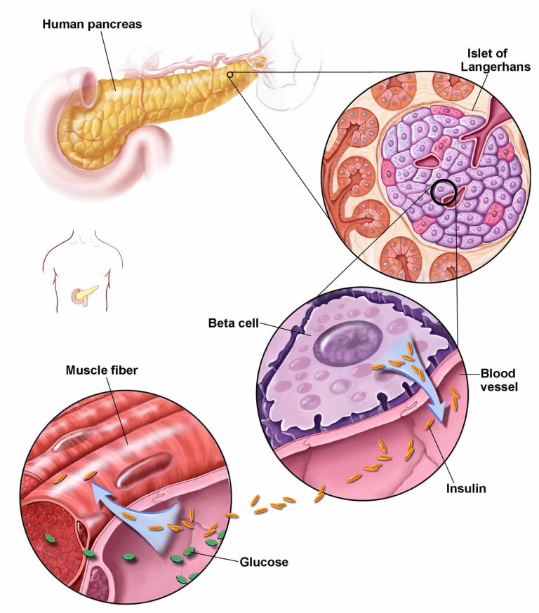 Prediabetes, causes, prevention, signs, symptoms, diagnosis & treatment