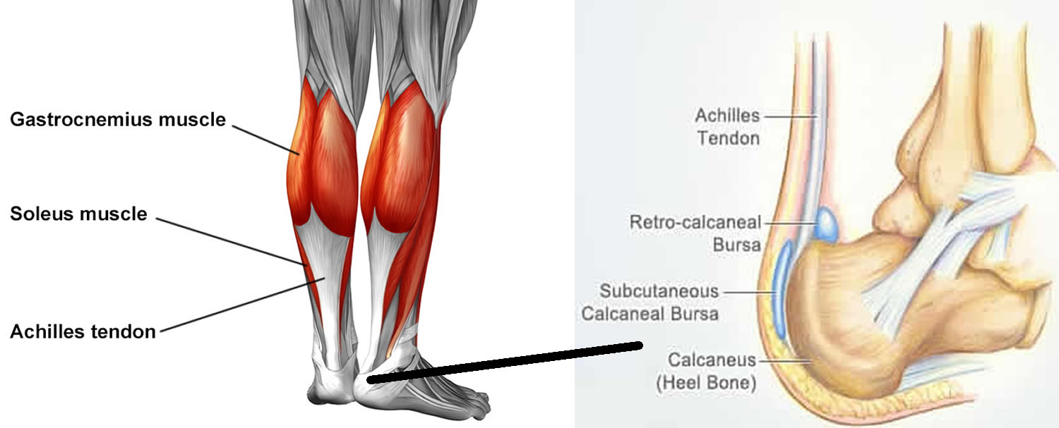 Achilles tendon