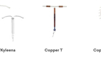 IUD contraceptive