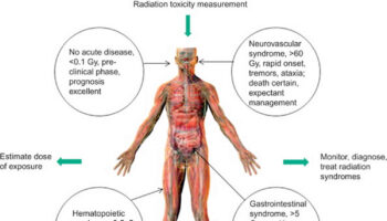 Acute radiation sickness