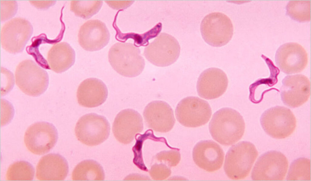 African Trypanosomiasis Causes Symptoms Diagnosis Treatment And Prognosis 0615