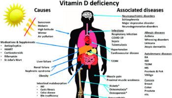 Vitamin D deficiency
