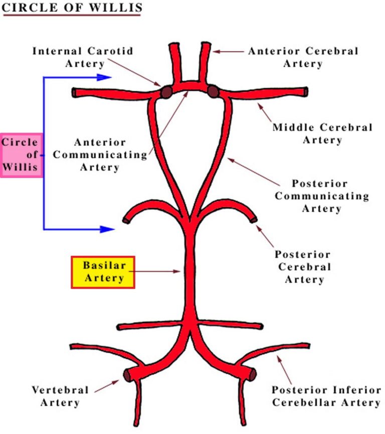 Basilar artery anatomy, aneurysm, thrombosis, hypoplasia ...