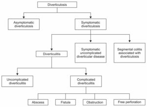 Diverticular disease, causes, symptoms, diagnosis & treatment