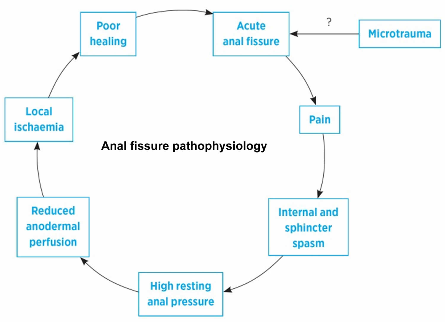 Anal fissure pathophysiology