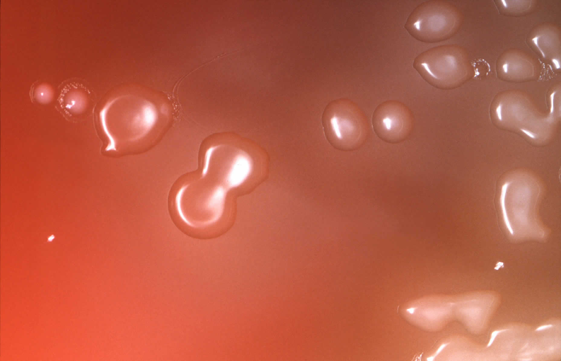 Streptococcus pneumoniae in blood agar