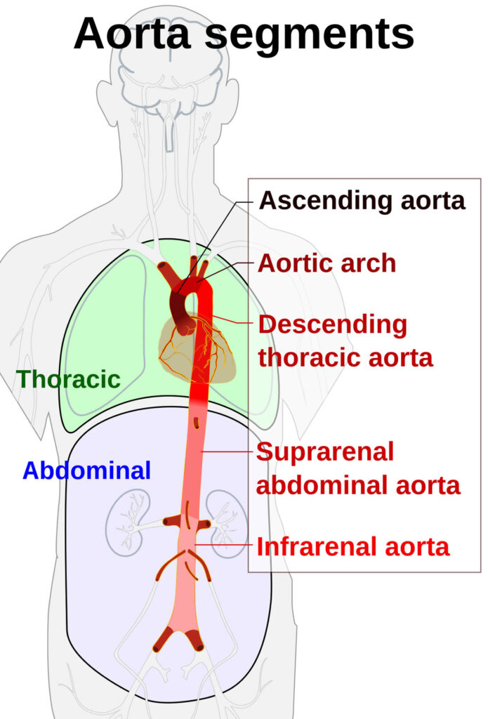 Abdominal aorta anatomy & abdominal aortic aneurysm