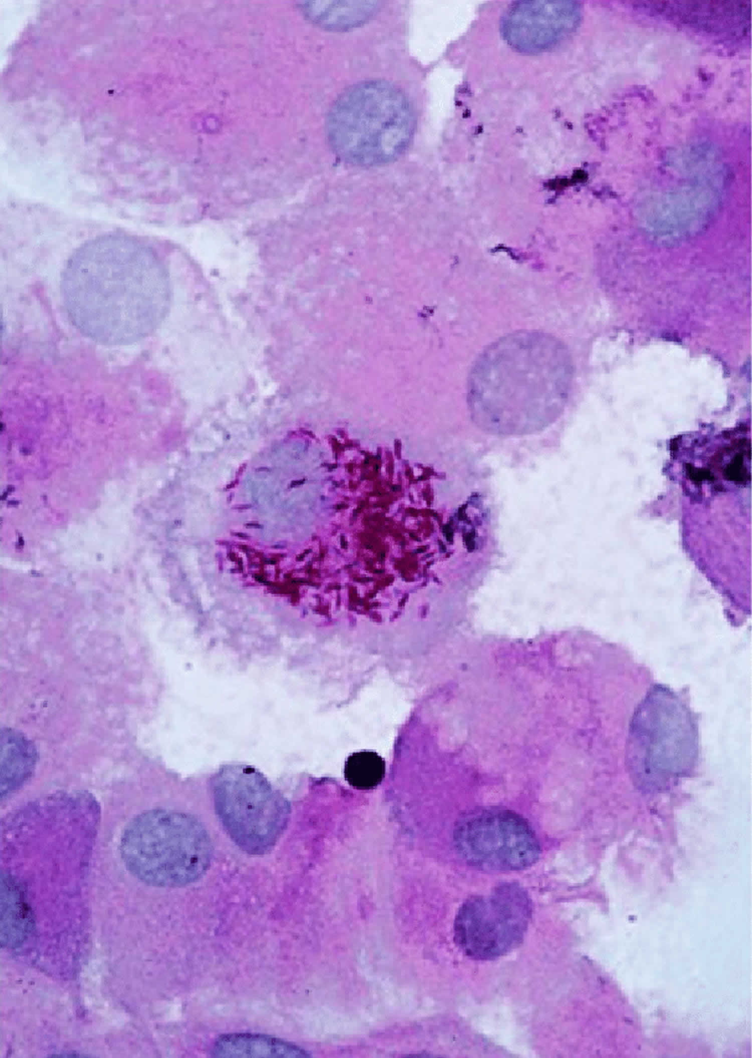 Tropheryma whipplei bacteria in human macrophages