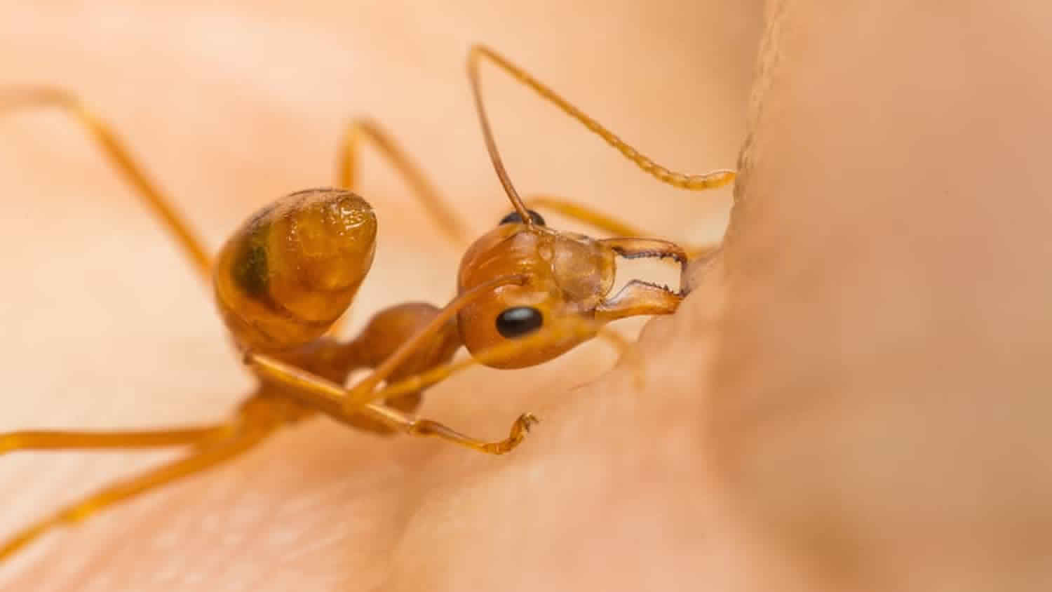 ant bites