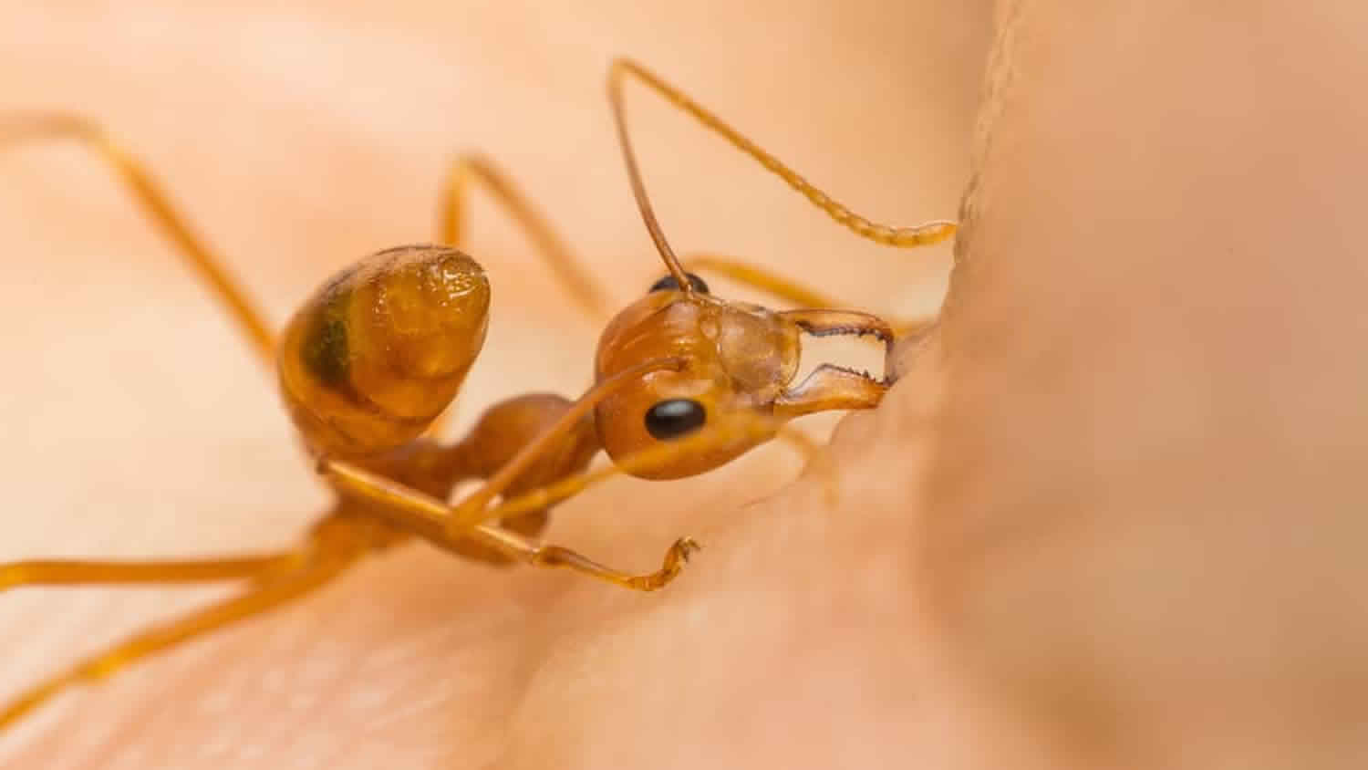 Ant Bites Stings Symptoms Diagnosis Treatment Prognosis