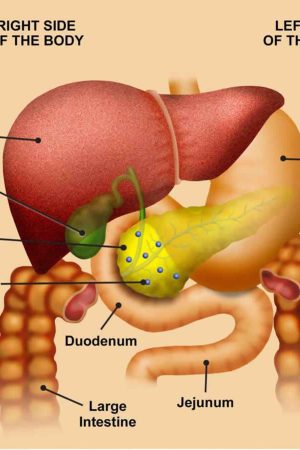 Familial pancreatic cancer