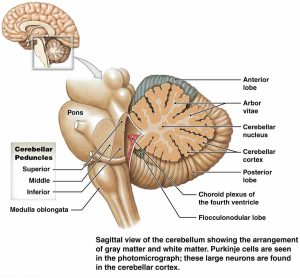 Ataxic cerebral palsy causes, symptoms, diagnosis, treatment & life ...